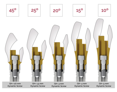 Gdiff Implants and Abutments - Next Day Dental Implants - Dynamic Dental ...